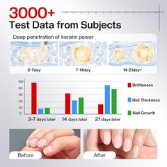 Morovan Nail Strengthener and Growth: 0.5 Fl Oz (Pack of 1), A1-milky white