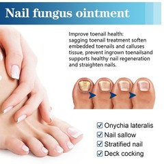 Nail Care Pen, 4/8/12Pcs Fungal Nail Pen, Nail Fungus Treatment For Toenail USA