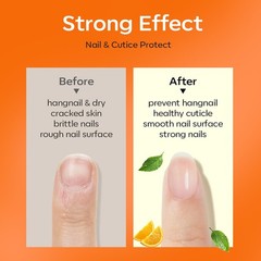 modelones Nail Strengthener 0.51 Fl Oz (Pack of 1), A3-Light Orange Oil