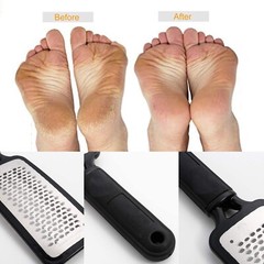 2pc Callus Feet File Hard Skin Remover Exfoliating Pedicure Tool Foot Rasp Shave