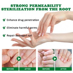 04/28 Ginger Nail Treatment, Ginger Cuticle Care Oil for Nails (2 PCS) USA SALE