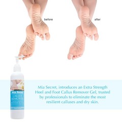 Mia Secret Professional Callus Remover Gel (8oz) – Salon-Grade 8 Ounce, Pink
