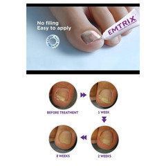 2X EMTRIX Fungal Nail Treatment 10ml Toenail & Fingernail Care Solution