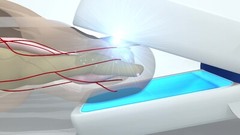 Medical Nail Laser, Anti Fungal and Cuticle Oil Starter Pack