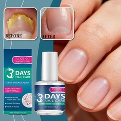 ROZINO 3 Days Nail Care – Keratin Amino Acid Formula Superior Nail Nourish 16ml