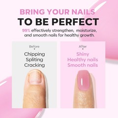 modelones Nail Strengthener 0.34 Fl Oz (Pack of 1), A6-Jelly Purple Pink