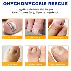 64 Pcs Fungal Nail Patches – Extra Strength Toenail Fungus Treatment Overnight