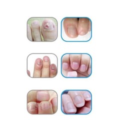 Oil Pen Nail Art Care Treatment Manicure | Nail Health | Nail Nutrition