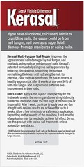 Kerasal MULTI-PURPOSE NAIL REPAIR for FINGERNAILS or TOENAILS Psoriasis Fungus