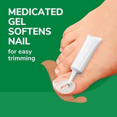 Dr. Scholl’s Ingrown Toenail Pain Reliever, 0.3 Ounce (Pack of 1), White