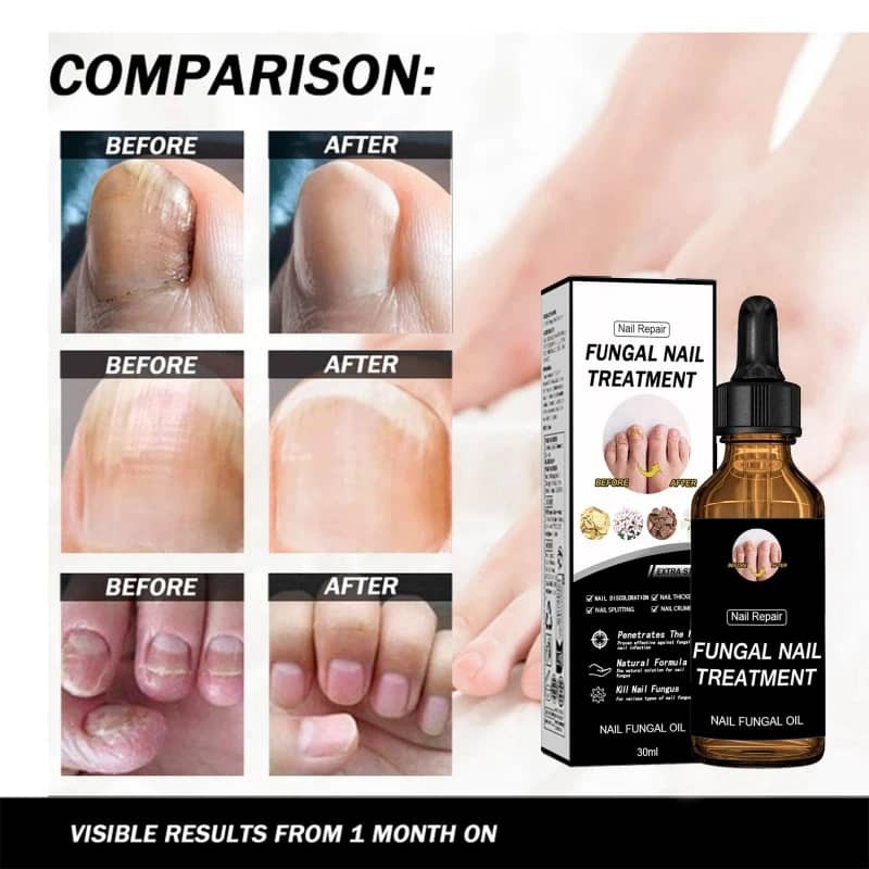 Nail Care Liquid Daily Cleaning Hand Foot Moisturizing Nail Fungus Treatment