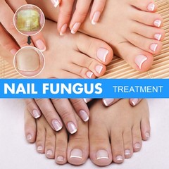 Nail Repair Liquid for Fungal Nails, Toenail Treatment ; Nail Strengthening