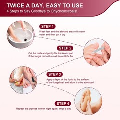 Toenail Fungus Treatment, Treatment Extra Strength 1 Fl Oz (Pack of 5), Red