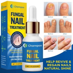 Toenail Fungus Treatment Extra Strength 30ml: Nail Cuticle Care Serum – gray