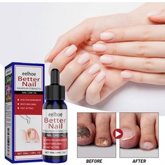 Nail Fungus Treatment Liquid with Moisturizing Formula for Toenail Health