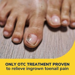 Dr. Scholl’s Ingrown Toenail Pain Reliever, 0.3 Ounce (Pack of 1), White