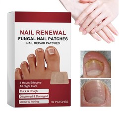 32Pcs Fungal Nail Repair Patch Nail Care Soft Nail Inlay Nail Correction Sticker