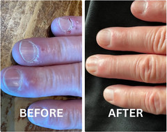 WellNail Nail & Cuticle Balm (1 oz) Fall in Love with Your Natural Nails Again!