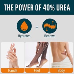 NUVADERMIS 40% Urea Cream – Full 5.29 Ounce (Pack of 1), Nuvadermis Original