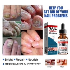 Nail Repair Liquid for Fungal Nails, Toenail Treatment ; Nail Strengthening
