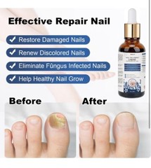 Toenail Fυngus Treatment, Nail Fυngus Treatment Extra Strength, Multi-Purpose