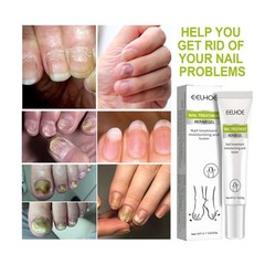 Nail Repair Gel Strengthening Treatment for Damaged Toe and Fingernails