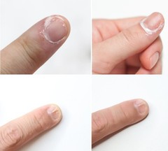 RIRE Miracle Cure Solution 20ml Nail Strengtheners Nail Care Korea Cosmetics NEW