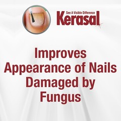 Kerasal MULTI-PURPOSE NAIL REPAIR for FINGERNAILS or TOENAILS Psoriasis Fungus