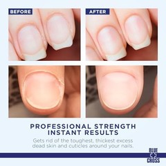Blue Cross Professional Nail Cuticle Remover & Softener Liquid, Hydrating