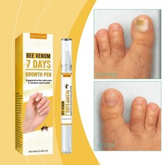 Month Nail Repair Liquid Hand Foot Nail Cleansing and Care Mild