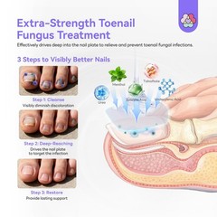 SAVILAND Toenail Fungus Treatment Extra Strength: 1 Fl Oz (Pack of 1), clear